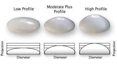 Several Types and Styles of Breast Implants